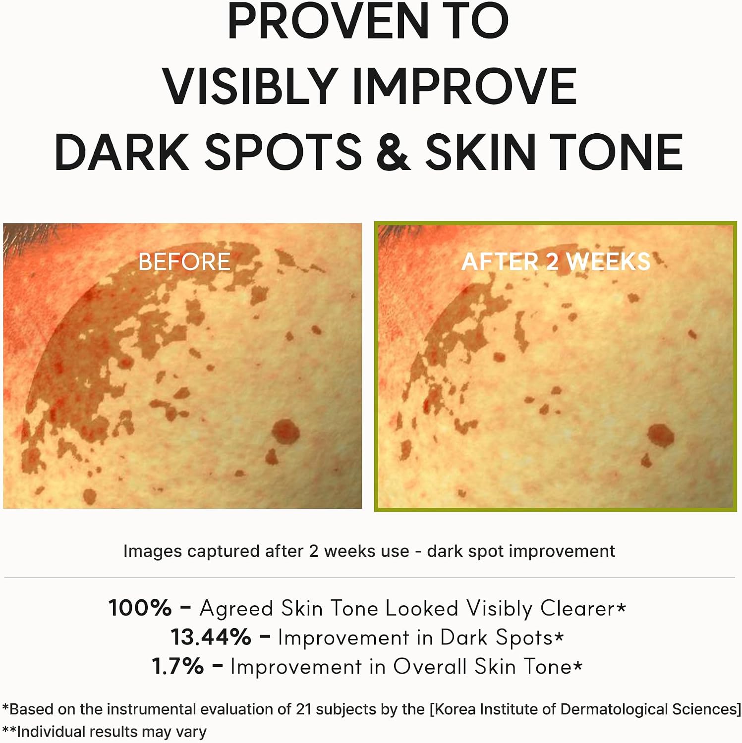 Arencia Vitamin C Booster Shot Serum with Glutathione, Niacinamide and Vitamin E for Dark Spot Care, Fine Lines & Wrinkles, Glass Skin, Korean Skincare 30ml/1.01 fl.oz - Image 7